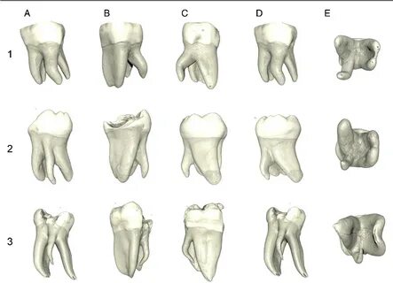 Curved Dental Root Elevator - Zft0 Series - Lascod S.p.a. 23E