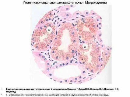 Микропрепарат канальцы почек