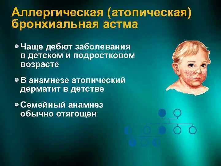 Классификация атопической астмы. Синдромальные формы бронхиальной астмы. Атопическая бронхиальная астма патогенез. Атопическая форма бронхиальной астмы. Формы бронхиальной астмы.