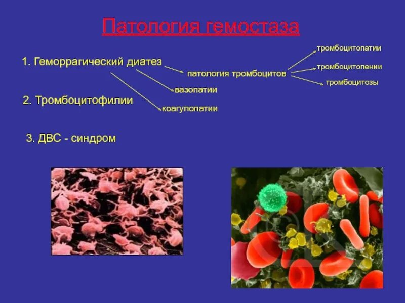 Тромбопения это. Патология гемостаза. Тромбоцитопении и тромбоцитопатии. Тромбоциты тромбоцитозы тромбоцитопении. Тромбоцитоз и тромбоцитопения.