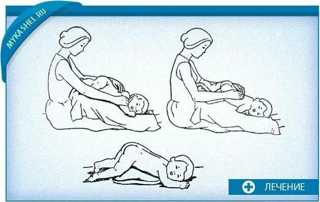 Дренажный массаж грудничку для отхождения мокроты. Дренажный массаж грудному ребенку для отхождения мокроты. Дренажный массаж ребенку для отхождения мокроты. Массаж для отхождения мокроты у ребенка 2 года.