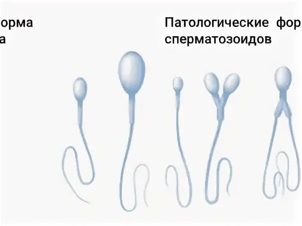 Забеременеть от предсеменной жидкости