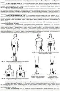 Электрофорез грудничкам зачем