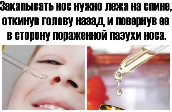 Как капать капли в нос. Как правильно закапывать нос. капать в нос. как правильно капать в нос. закапывает в нос.