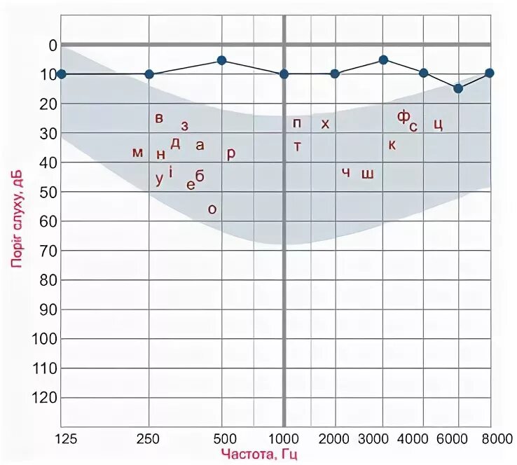 Аудиограмма у детей. Аудиометрия Результаты. Тональная аудиограмма в норме бланк. Типы аудиометрических кривых. Аудиограмма в спб