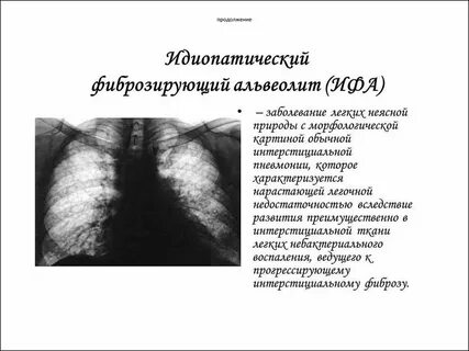 Симптомы фиброза легких