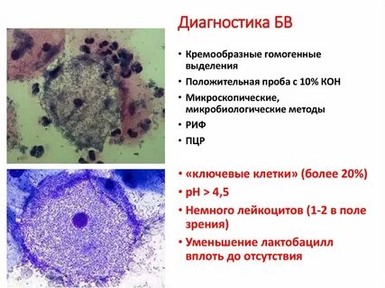 Ключевые клетки большое количество