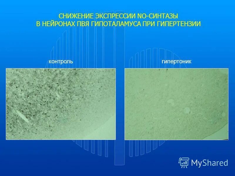 Снижение экспрессии. Динамика иммунологического обследования. Антигены hla отсутствуют. Экспрессия генов. Снижение экспрессии.