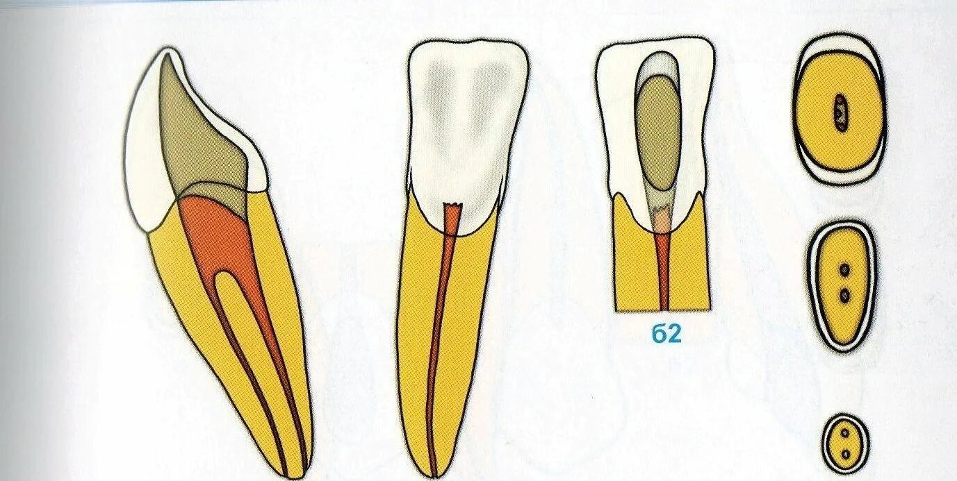 Нижний резец 2 корневых канала. Устья корневых каналов резцов. Анатомия пульповой камеры резцов. Топография корневого канала резца. Формы корневых каналов
