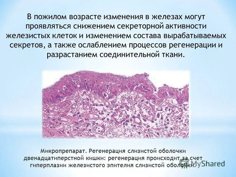 Гистологическое исследование что это такое в онкологии. Гемангиосаркома печени гистология. Язвенный проктит гистология. Гистология в гинекологии. Гистология в гинекологии.