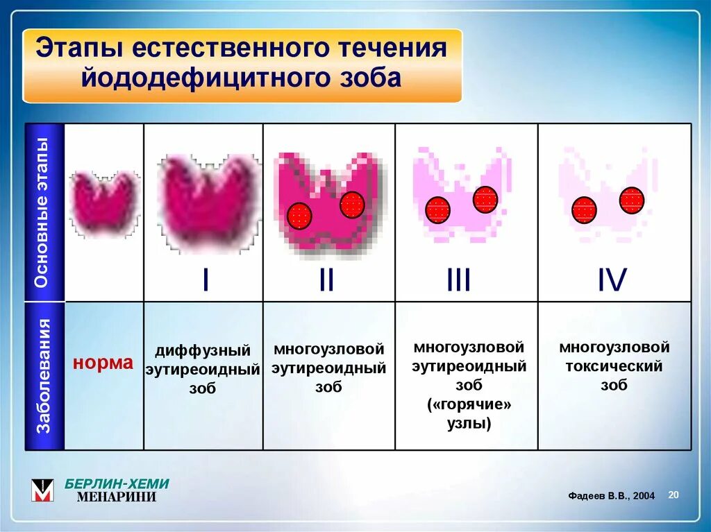 Диффузно многоузловой зоб. Зоб щитовидной железы классификация 1 степени. Диффузный и Узловой токсический зоб классификация. Диффузный эутиреоидный зоб классификация. Диффузно-Узловой зоб щитовидной железы 3 степени.