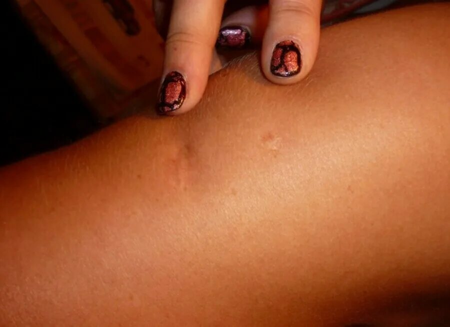 Отметка на плече. Плечо и предплечье у человека анатомия. Название частей руки. Рука человека плечо. Ребенок на плече.