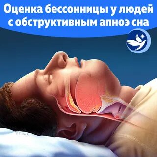 Почему человек храпит во время сна