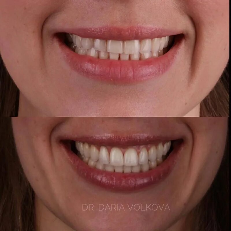 красивые ровные зубы. улыбка когда выйдет. огромная щель между зубами. красивые зубы. улыбка.