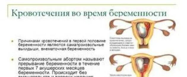 Возможны месячные при беременности на ранних сроках. Месячные при беременности на ранних сроках. может ли идти менструация при беременности. могут ли идти месячные при беременности. может ли при беременности идти месячные на ранних сроках.
