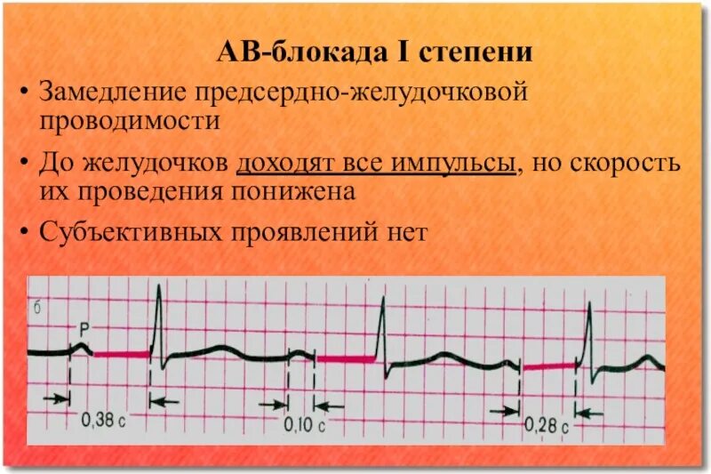 Блокада первой степени