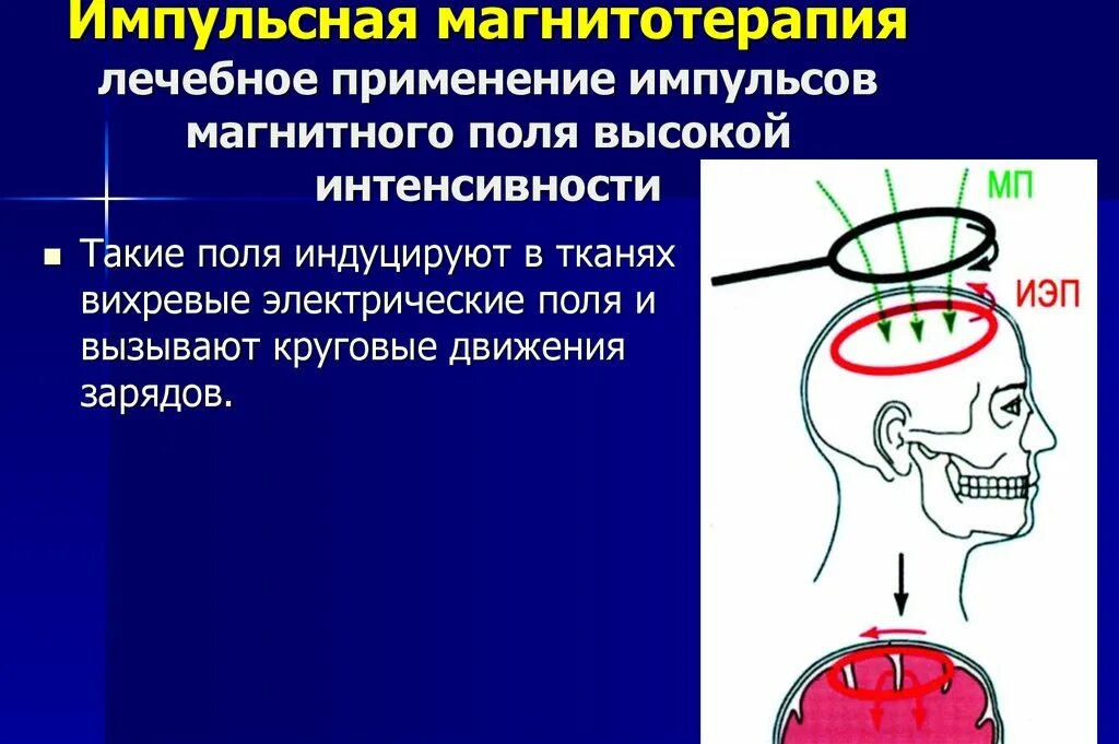 Локальное воздействие постоянного магнитного поля на человека. Импульсное магнитное поле в медицине. Низкочастотные магнитные поля медицина. Магнитотерапия магнитное поле. Аппарат низкоинтенсивное импульсное магнитное поле.