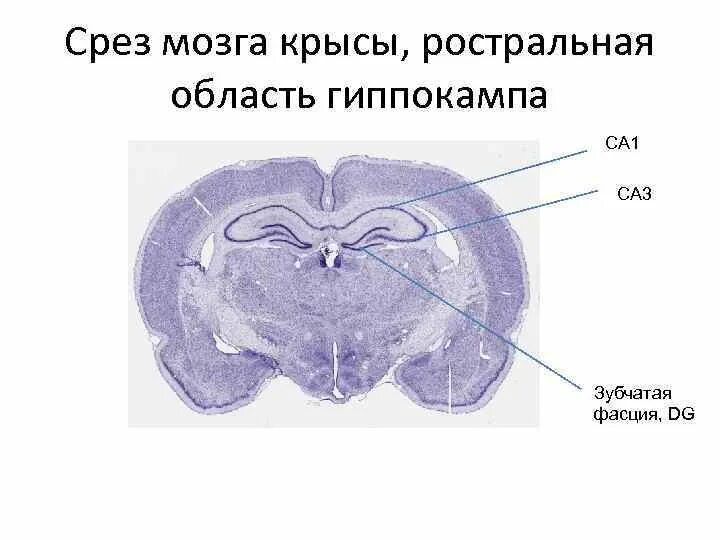 Спайки головного мозга. Гиппокамп крысы гистология. Срез головного мозга гистология. Строение гиппокампа гистология. Гиппокамп на срезе мозга крысы.