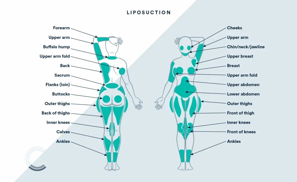 Back area. Thighs на теле человека. Flank часть тела человека. Outer thigh. Thigh Parts.