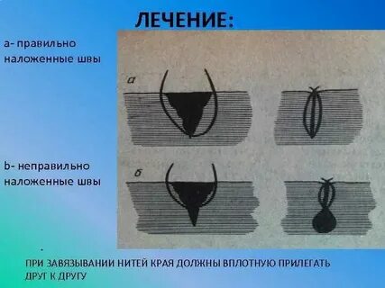 Количество зарасти