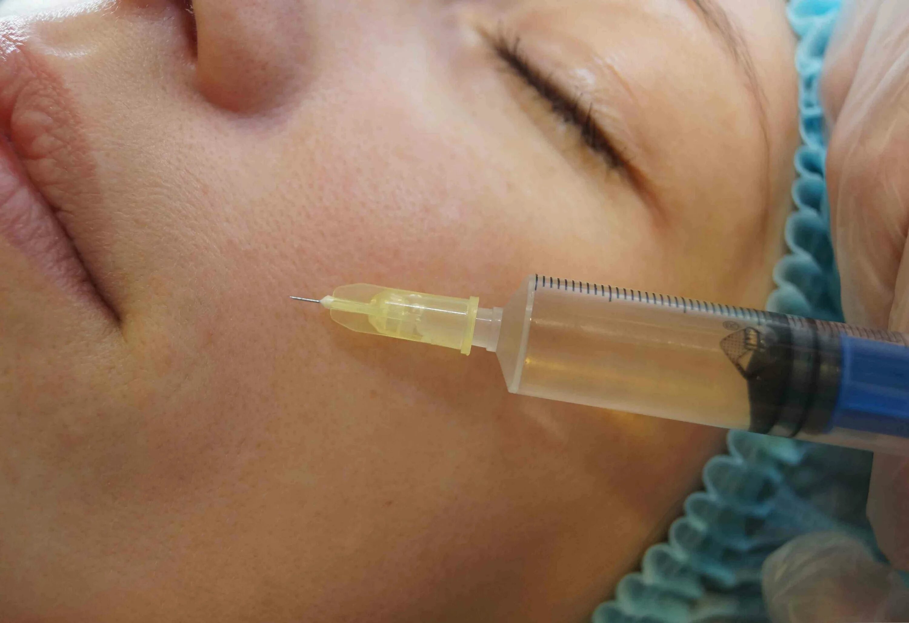 Плазма основные законы. Плазмолифтинг для лица. Ли плазма. Плазмолифтинг этапы процедуры. Огненный фон.