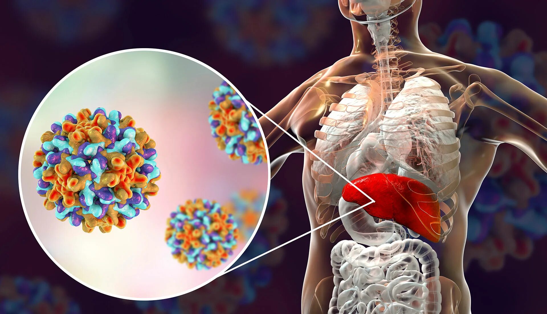 Вирус гепатита b. Вирусные гепатиты картинки.