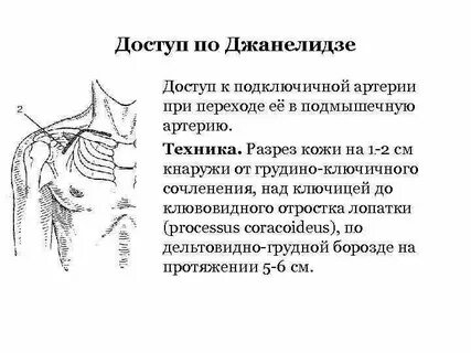 Сонно подключичное