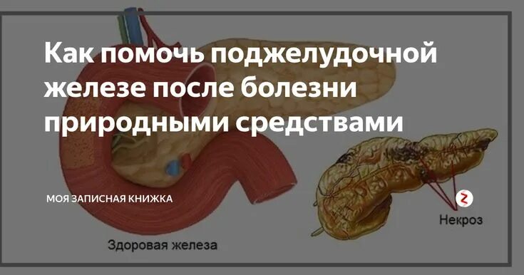 Как восстановить поджелудочную железу после
