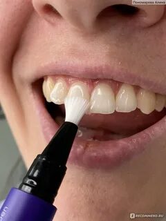 Smilebe отбеливание