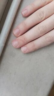 Впадина на ногте большого