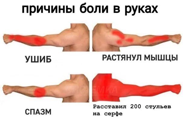 Почему болят руки без причины. Почему болят мышцы. Боль в руке.