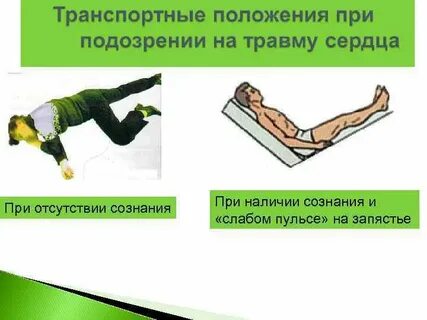 Оптимальное положение при отсутствии сознания