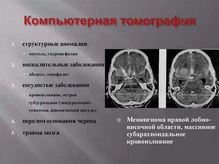 Кт можно при гв