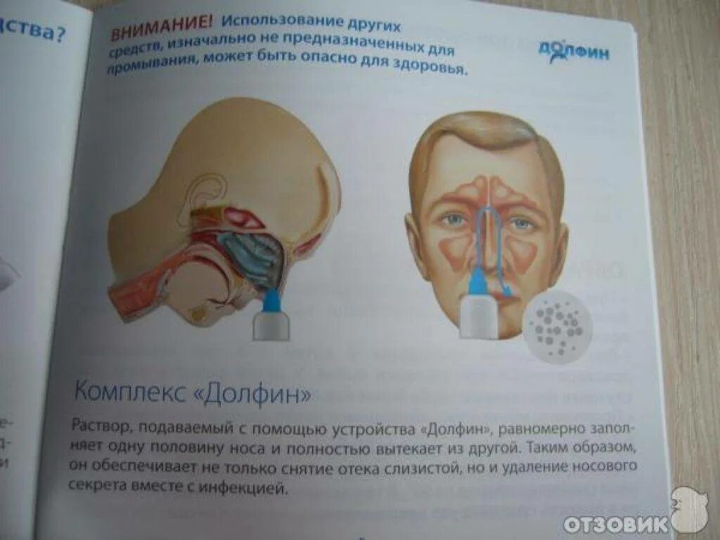 Промывание носа при гайморите в домашних. Синусит промывание долфином. Пробивание носа при гацморите. Как промывать нос долфином. Промывать нос при гайморите.