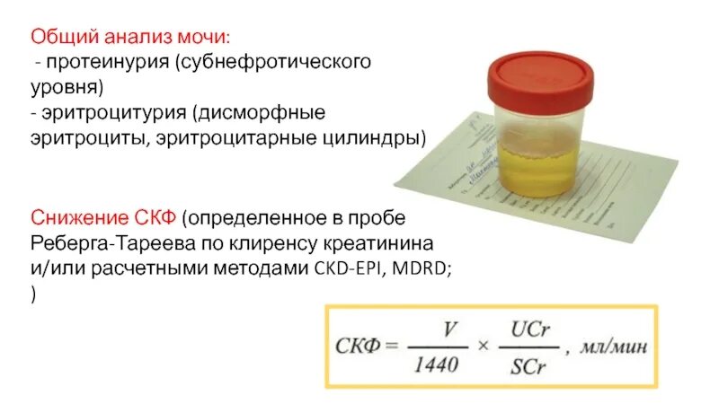 Моча 8 класс