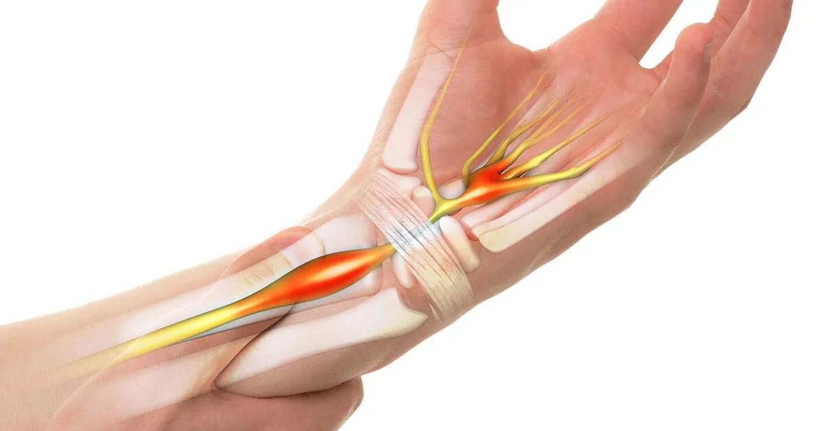 Отдает в правый бок. Межреберная невропатия. Мышечная слабость. Онемение в боку. Болит бок.