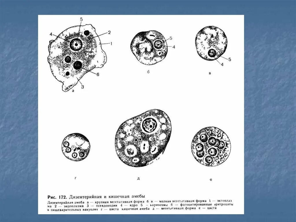 В каком организме происходит развитие дизентерийной амебы. Вегетативная форма дизентерийной амебы. Патогенная форма дизентерийной амебы. Строение цисты дизентерийной амебы. Мелкая вегетативная форма амебы дизентерийной.