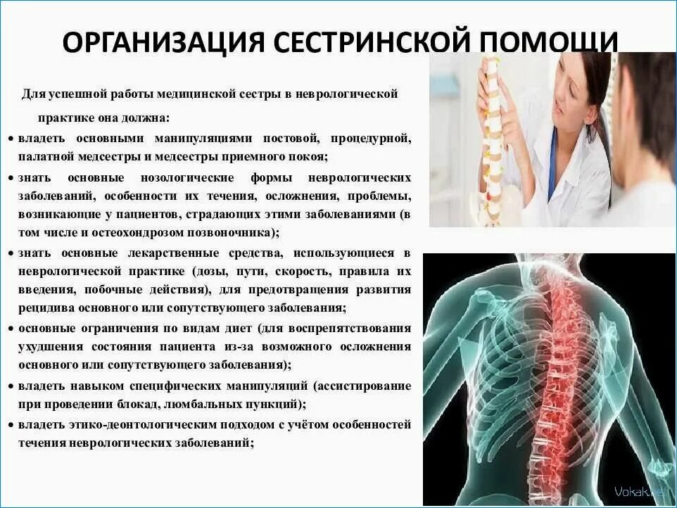 Обострение шейного остеохондроза лечение в домашних. Остеохондроз отдела позвоночника. Клинические симптомы остеохондроза. При остеохондрозе грудного отдела. Остеохондроз шейного отдела.