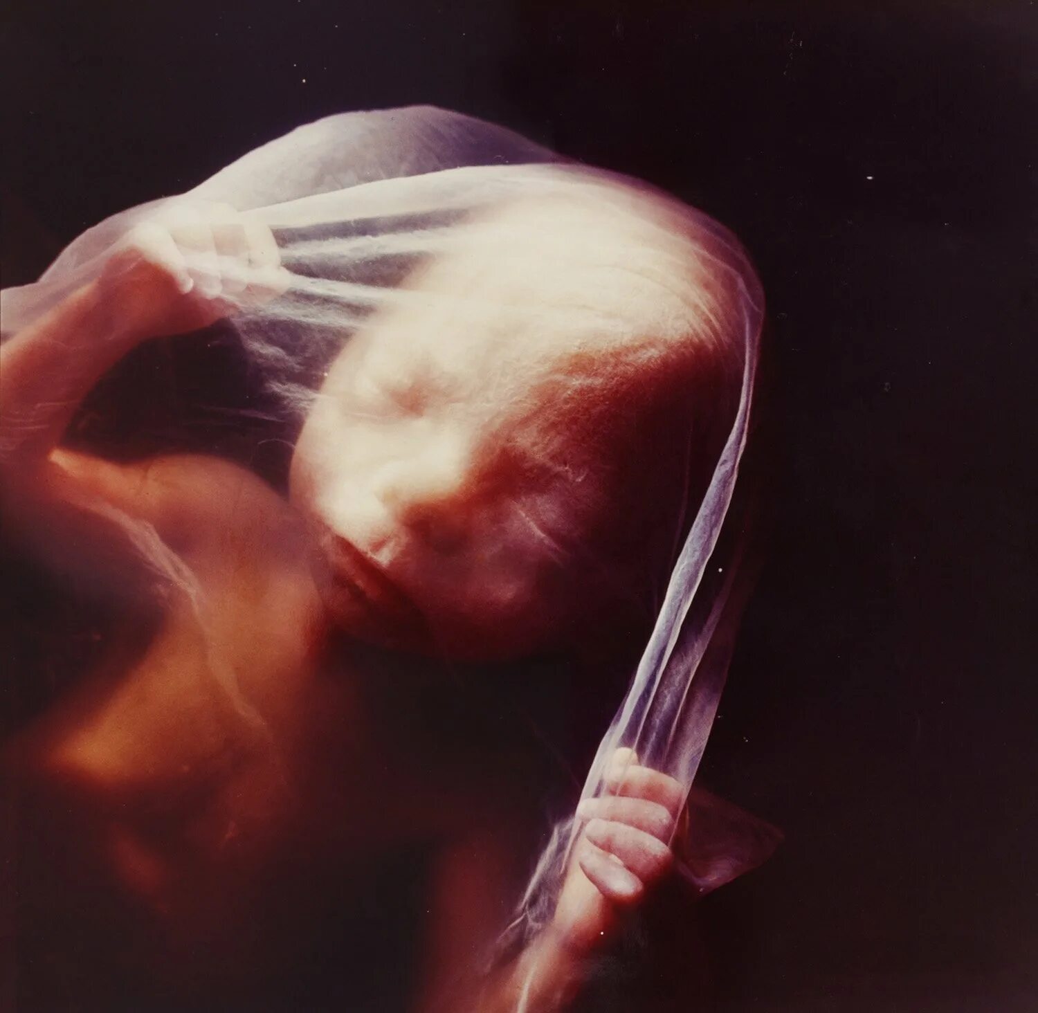 Эмбрион Леннарт Нильсон. Эмбрион 18 недель Леннарт Нильссон. "Зародыш, 18 недель", Леннарт Нильсон, 1965.. Малыш на 19 неделе