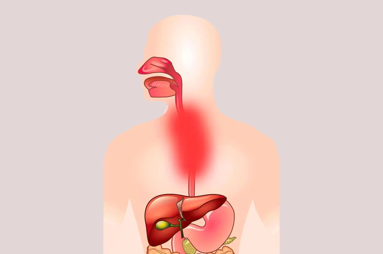 Пищевода тошнота
