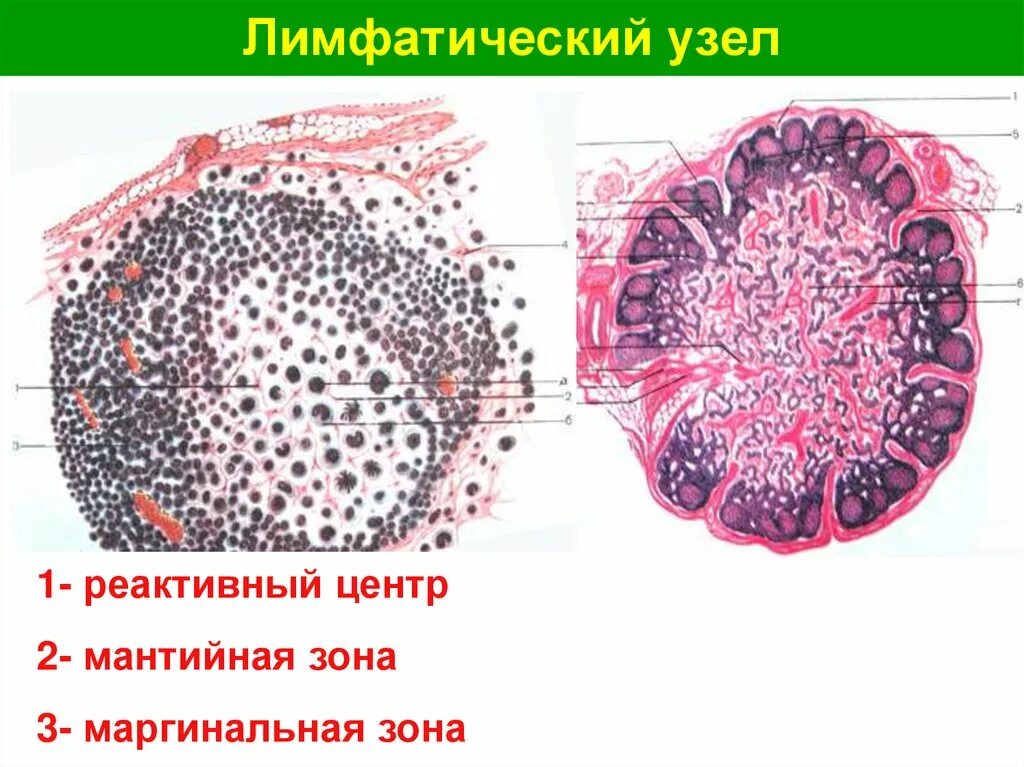 Межузелковая зона лимфатического узла. Строение лимфатического узла гистология. Лимфоидный узел гистология. Мантийная зона лимфоузла. Реактивная гиперплазия лимфоузла