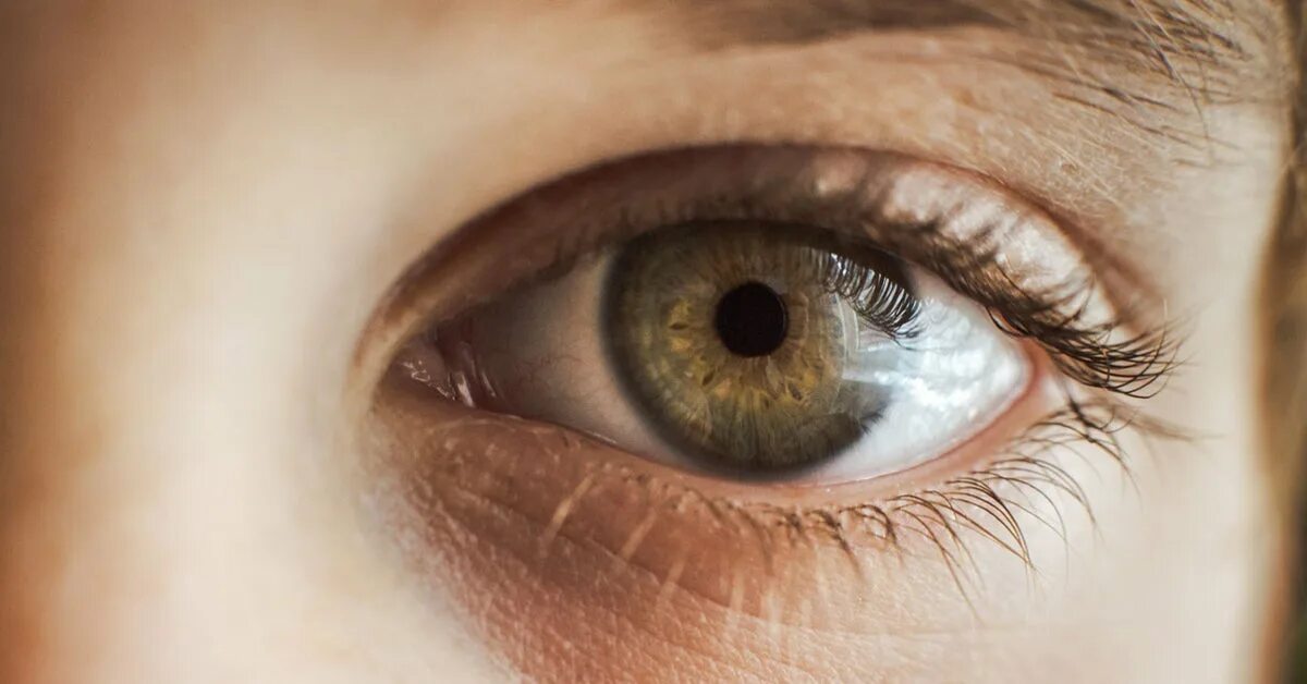 Составить слепота. Слепота (blindness). катаракта куриная слепота.