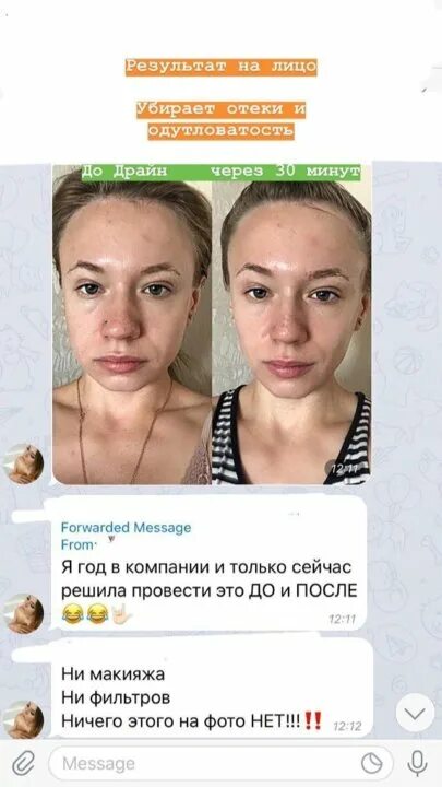 Драйн эффект от отеков. Драйн эффект результаты. драйн эффект до и после. драйн нл. драйн эффект фото до и после.