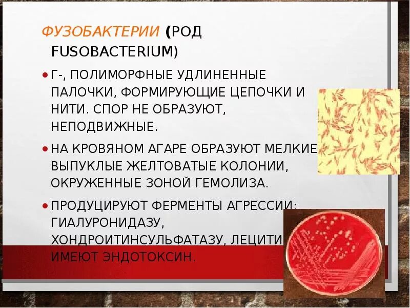 Fusobacterium spp. Фузобактерии нуклеатум. фузобактерии микробиология характеристика. фузобактерии (род fusobacterium). фузобактерии на кровяном агаре.