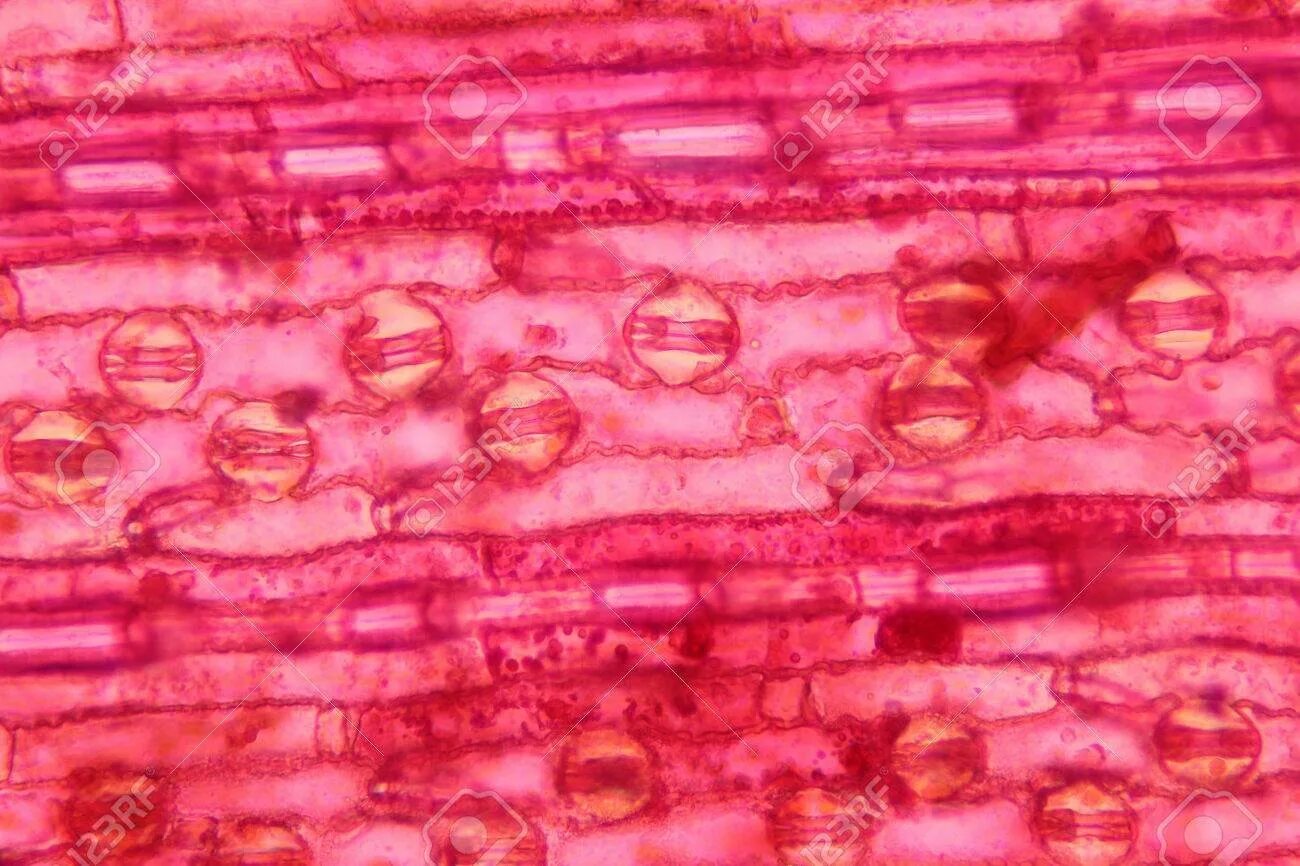 Клетки томата под микроскопом. Микропрепарат мякоти томата. Мякоть томата под микроскопом. Строение мякоти яблока арбуза и томата. Строение клетки мякоти томата.
