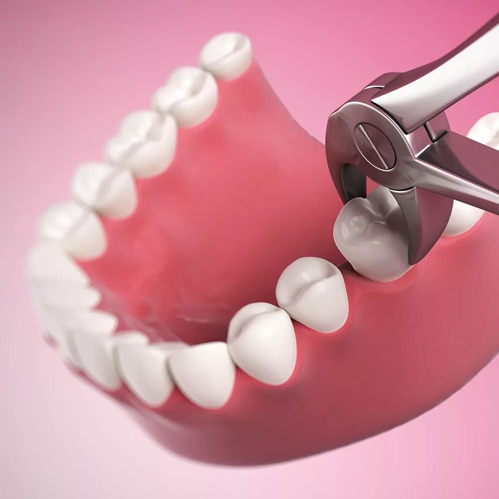 Зубы стоматология. Хирургическая стоматология.