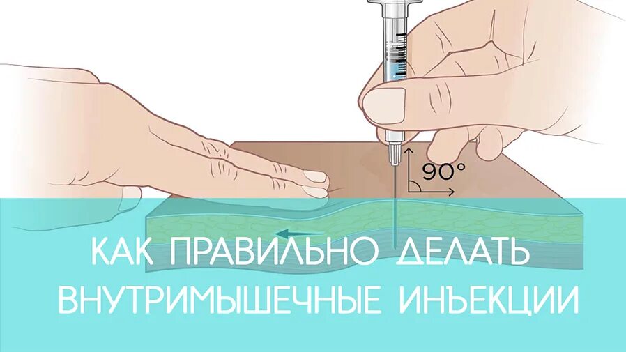 Как не больно сделать укол в ягодицу. Как правильно делать укол. Укол внутримышечно. Куда делать укол. Укол внутримышечно в ягодицу.