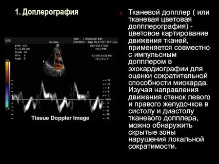 Можно ли на доплере
