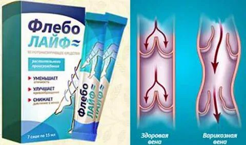 Флебо