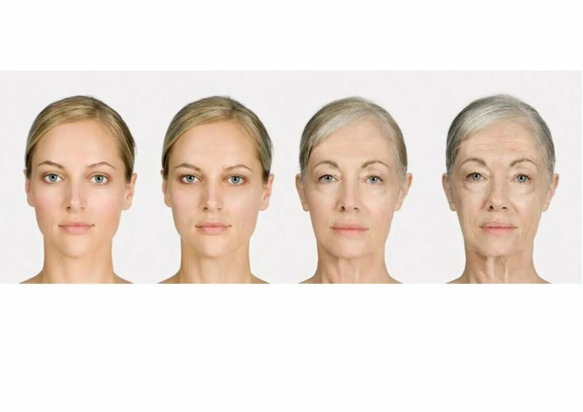 Возрастные изменения лица. Возрастные изменения кожи лица. Возрастные изменения лица у женщин. Этапы старения женского лица.